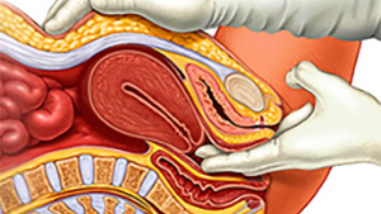 Endometriozis Belirtileri, Tedavi Yöntemleri Ve Yaşam Kalitesine Etkisi - Yazar Kadın