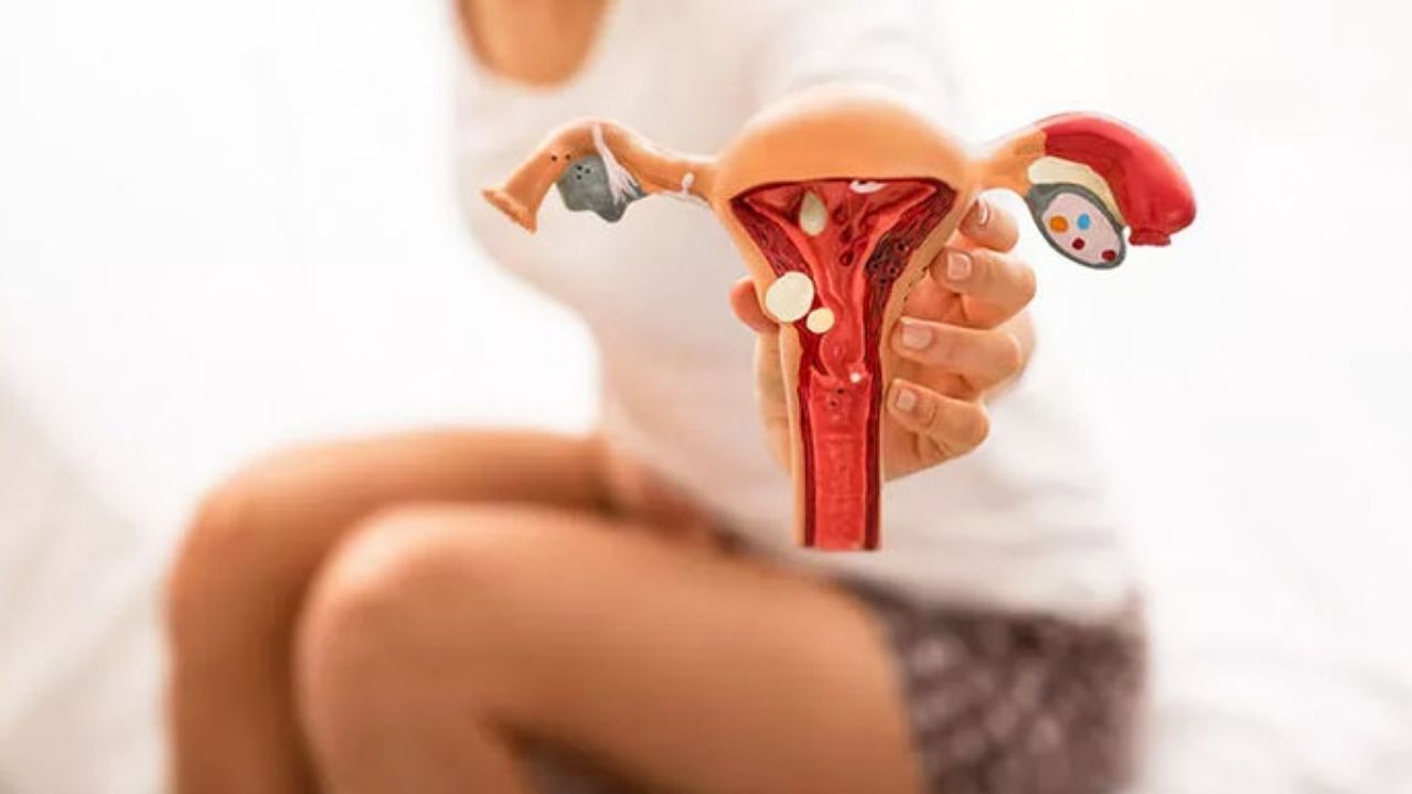 Endometriozis Ve Fertilite Hamilelik Üzerindeki Etkileri - Yazar Kadın