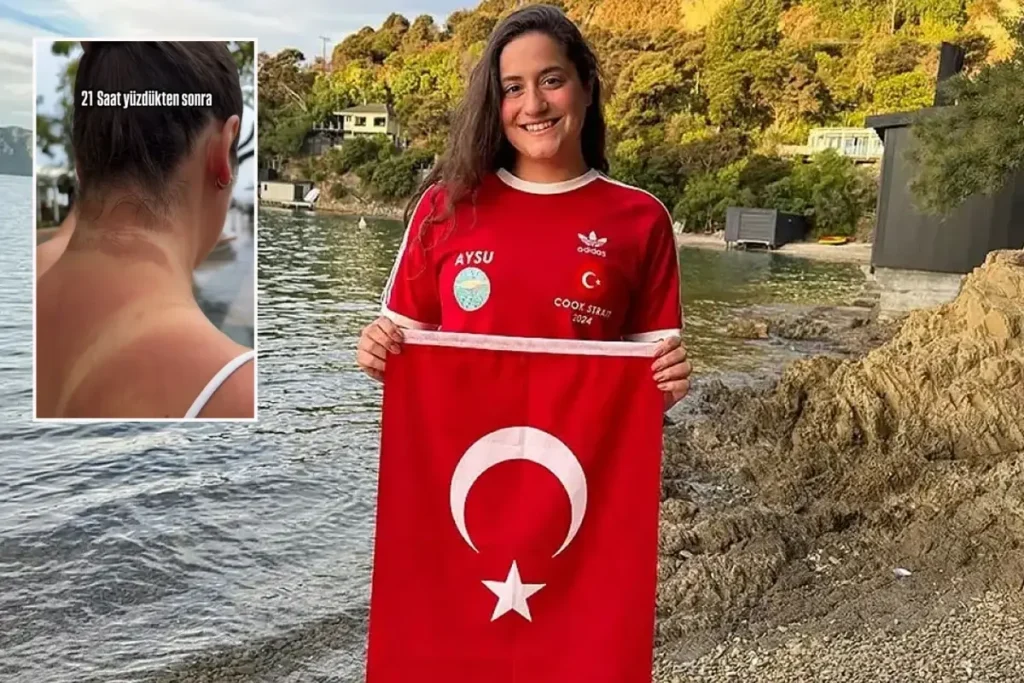 65 Kilometre Yuzen Aysu Turkoglu Nun Vucudundaki 18568449 4264 Amp - Yazar Kadın