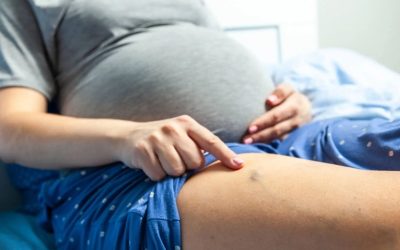 Hamilelikte Varis: Sebepleri, Belirtileri ve Tedavi Yöntemleri