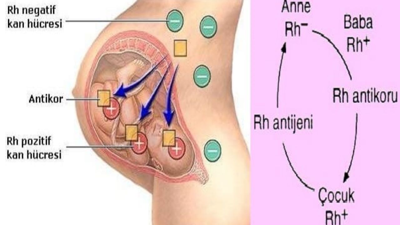 İndirekt Coombs Testi Tanı, Uygulama Alanları Ve Klinik Önemi - Yazar Kadın