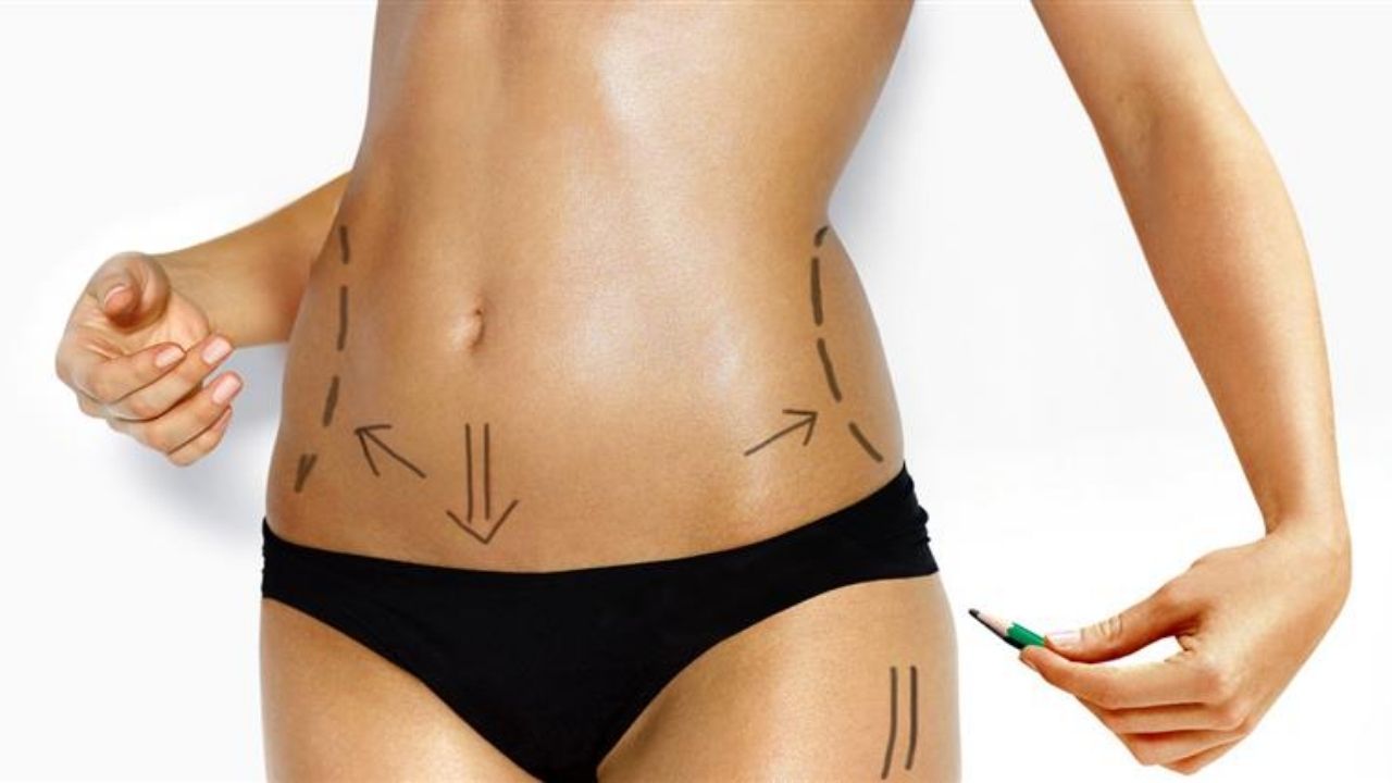 Karın Germe Ve Liposuction İki Popüler Plastik Cerrahi Seçeneği Birleştirme - Yazar Kadın