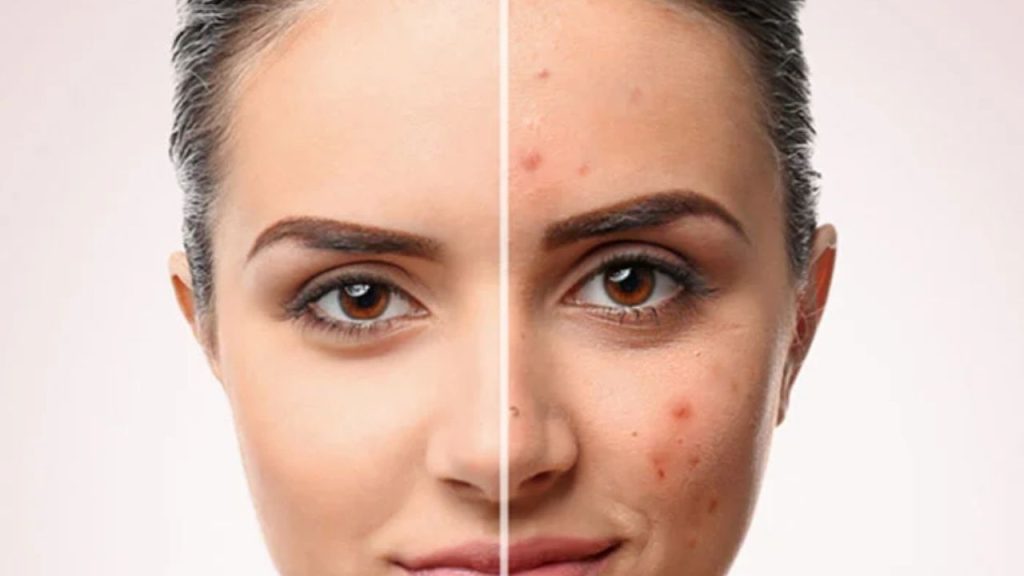 Hormonal Değişimlerin Cilt Üzerindeki Etkileri Ve Bakım Önerileri - Yazar Kadın