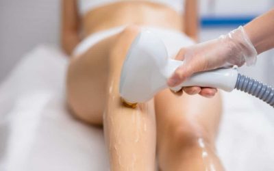Buz Epilasyon Acıtır mı? Gerçek Kullanıcı Yorumları