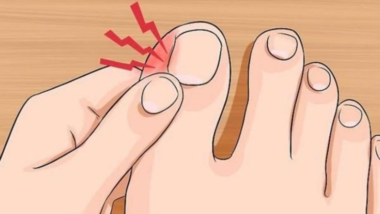 Gebelikte Tırnak Batması Güvenli Müdahale Yöntemleri - Yazar Kadın