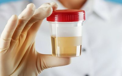 Kadınlarda İdrarda Kan Görülmesinin Nedenleri: Hangi Durumlar Ciddiye Alınmalı?