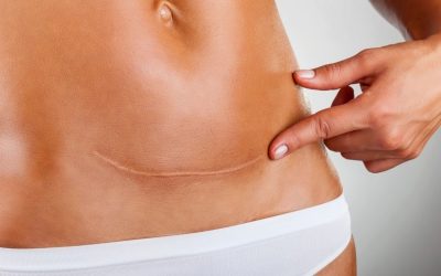 Normal Doğum Sonrası İyileşme Süreci ve Dikkat Edilmesi Gerekenler