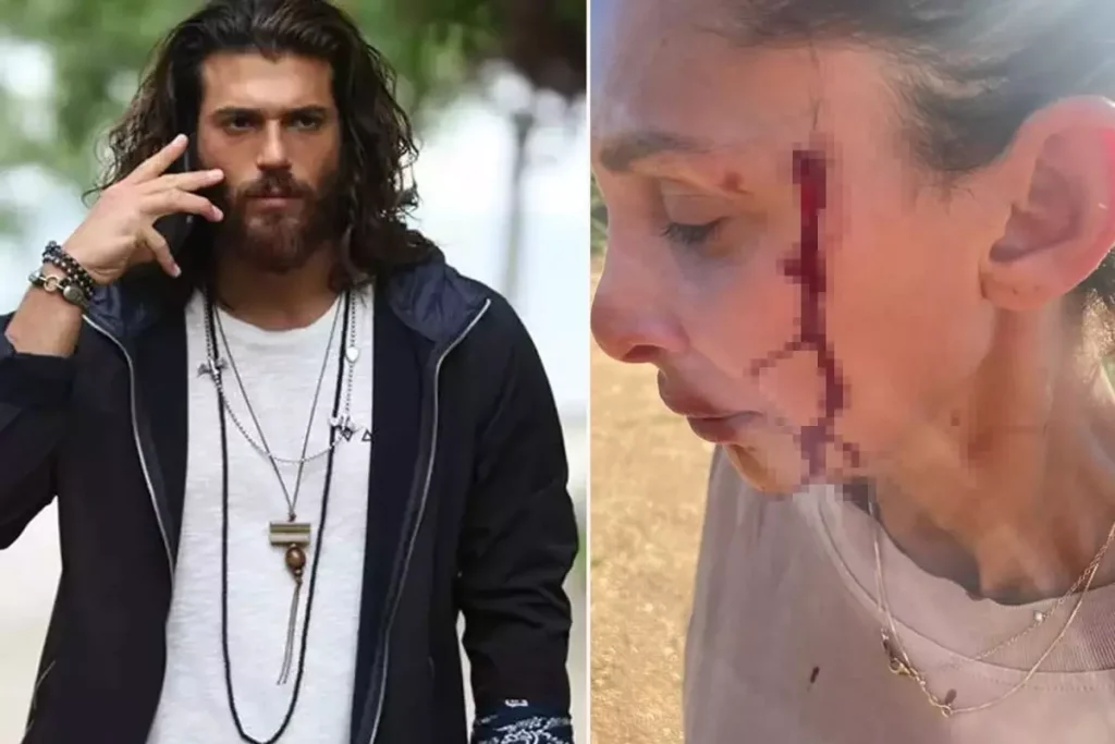 Can Yaman In Sevgilisi Sara Bluma Siddet 18862701 9220 Amp - Yazar Kadın
