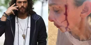 Can Yaman’ın sevgilisi Sara Bluma şiddet gördüğünü itiraf etti