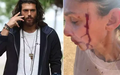 Can Yaman’ın sevgilisi Sara Bluma şiddet gördüğünü itiraf etti