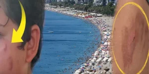 Denize Girenler Yanık Tehlikesiyle Karşı Karşıya