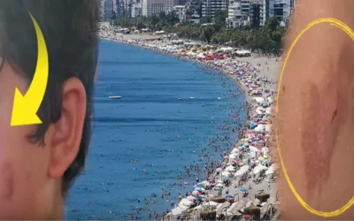 Denize Girenler Yanık Tehlikesiyle Karşı Karşıya