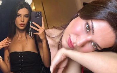 Devrim Özkan Ameliyat Sonrası İlk Kez Görüntülendi: “İyileştim Sayılır!”