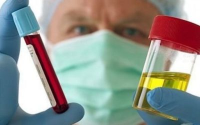Kadınlarda Hematüri (İdrarda Kan): Tanı ve Tedavi Süreci
