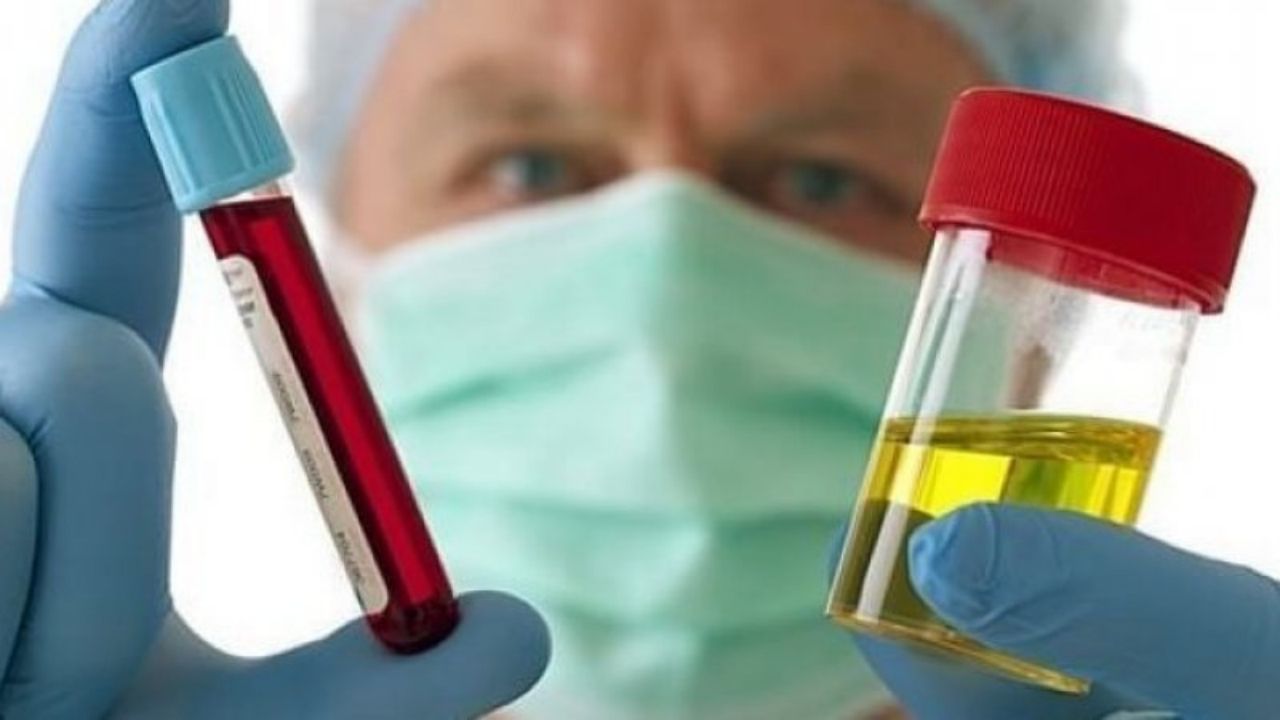 Kadınlarda Hematüri (İdrarda Kan) Tanı Ve Tedavi Süreci - Yazar Kadın