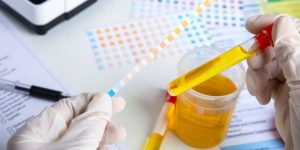 Kadınlarda İdrardan Kan Gelmesi Hangi Branş Doktoruna Gidilmeli?