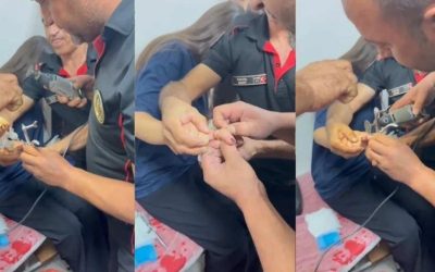 Kahramanmaraş’ta İtfaiye Ekibi Genç Kızın Parmağındaki Yüzüğü Kurtardı