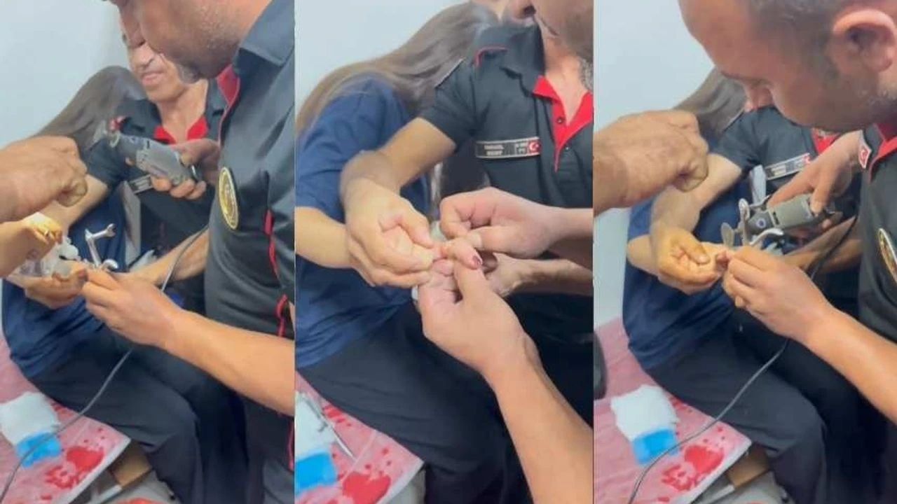 Kahramanmaraş'ta İtfaiye Ekibi Genç Kızın Parmağındaki Yüzüğü Kurtardı - Yazar Kadın