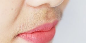 Hormonel Dengesizlik ve Aşırı Tüylenme: Ne Zaman Doktora Gidilmeli?
