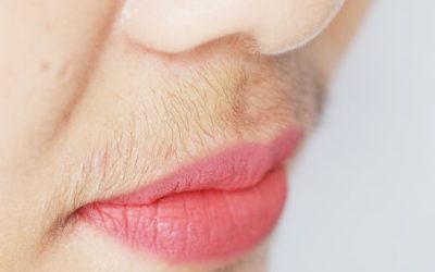 Hormonel Dengesizlik ve Aşırı Tüylenme: Ne Zaman Doktora Gidilmeli?