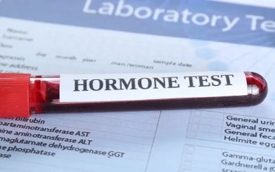 Hormon Testleri ile Adet Problemlerinin Teşhisi