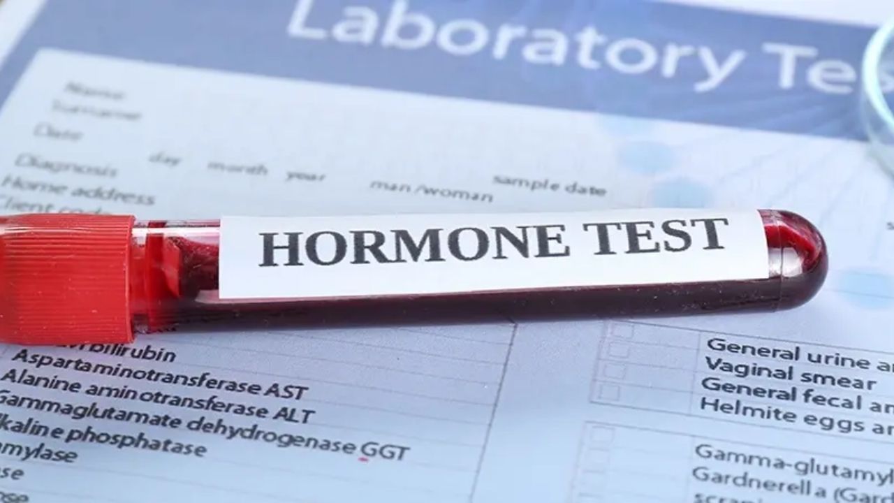 Hormon Testleri Ile Adet Problemlerinin Teşhisi - Yazar Kadın