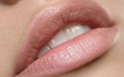 Kadınlarda Dudak Dolgusu: Sıkça Sorulan Sorular ve Cevapları