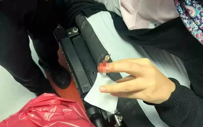 Batman’da Blender Kullanımı Kaza Getirdi: Ev Hanımı Yaralandı