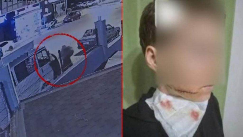 Alanya'da Ukraynalı Kadına Saldırı Zanlı Tutuklandı - Yazar Kadın