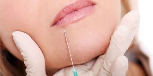 Dudak Kaldırma: Kadınlarda Sıkça Sorulan Sorular