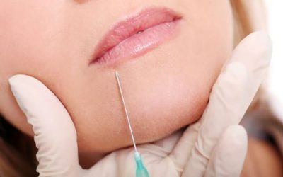 Dudak Kaldırma: Kadınlarda Sıkça Sorulan Sorular