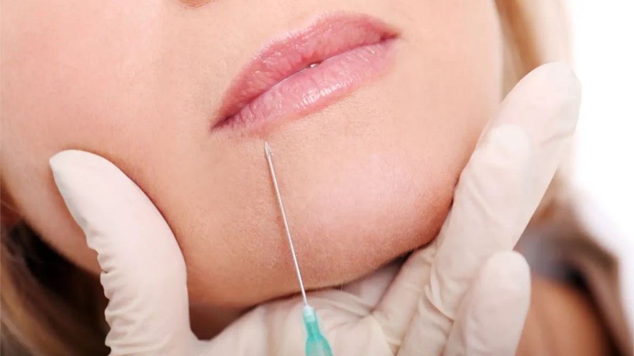 Dudak Kaldırma Kadınlarda Sıkça Sorulan Sorular - Yazar Kadın