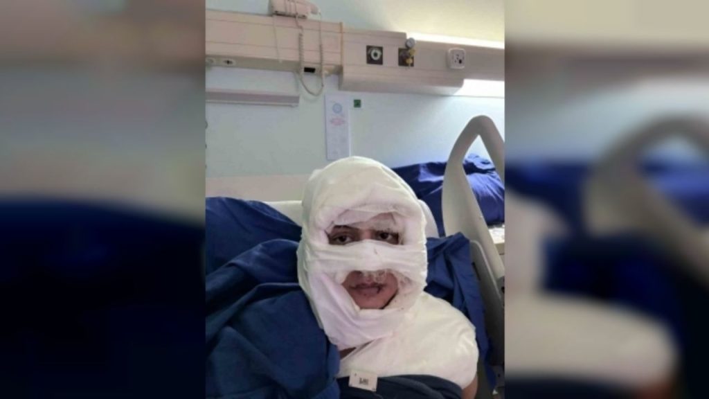 Kadıköy’de Dehşet Genç Kadının Yüzüne Yanıcı Madde Döküp Ateşe Verdi! Şüpheli Kadın Tutuklandı - Yazar Kadın