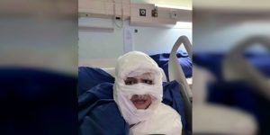 Kadıköy’de dehşet: Genç kadının yüzüne yanıcı madde döküp ateşe verdi! Şüpheli kadın tutuklandı