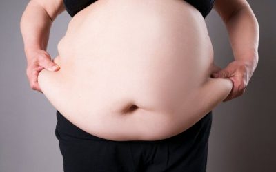 Kadınlarda Obezite Riskini Hesaplama: Evde Uygulayabileceğiniz Pratik Yöntemler