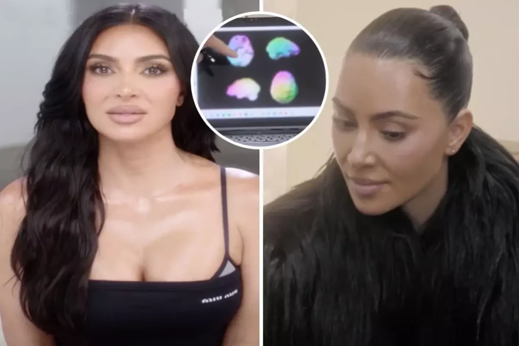 Kim Kardashian In Beyin Taramasindan Dusuk 19306427 7881 Amp - Yazar Kadın