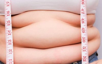 Kadınlar İçin Obezite Sınırı Nedir? Belirleyici Kriterler ve Öneriler