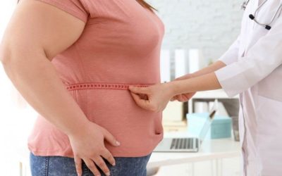 Kadınlarda Obezite Kaç Kilo Sayılır? Doktorların Kriterleri