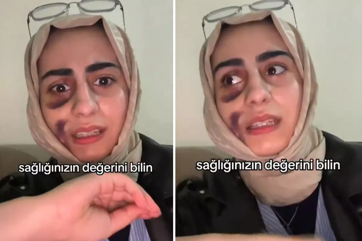 Stajyer Doktora Tedavi Olan Kadin Video Cekip 19329874 125 Amp - Yazar Kadın